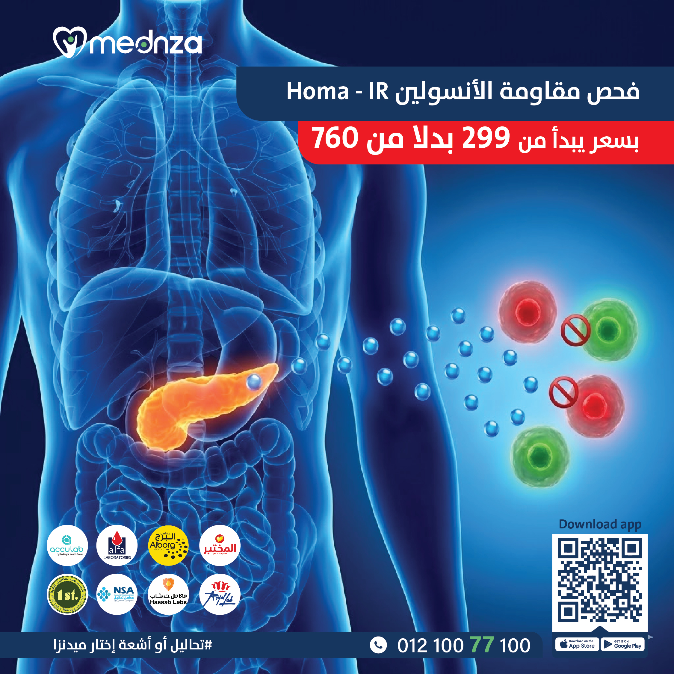 Insulin Resistance (HOMA - IR - INDEX) ,in serum - مقاومة انسولين